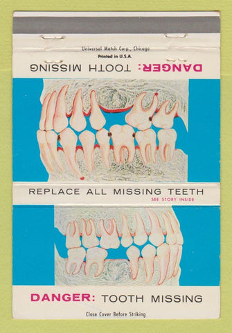 Matchbook Cover - Durallium Products Teeth Health Chicago IL 40 Strike